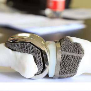 3D Print Knee Joint